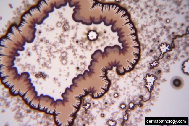 Melanoma Diagnosis and Management Updates