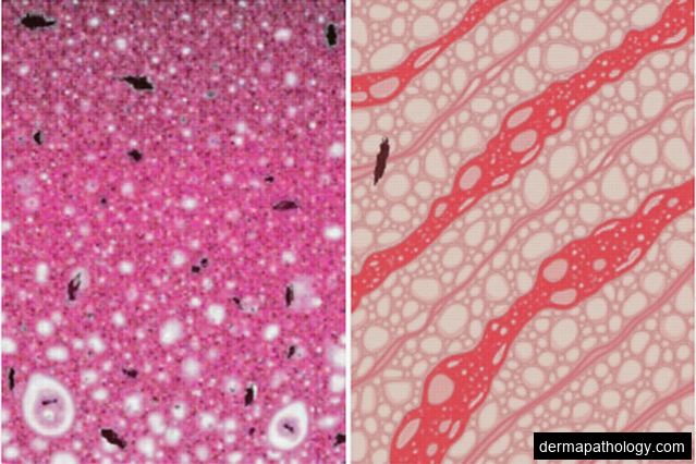 Autoimmune Skin Disorders Explained